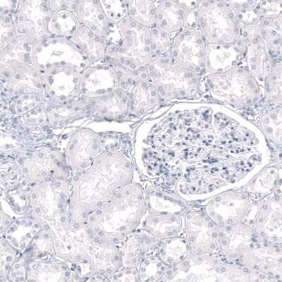 Immunohistochemistry-Paraffin: GPR17 Antibody (CL10474) [NBP3-07993]
