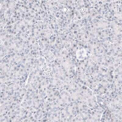 Immunohistochemistry-Paraffin: GPR17 Antibody (CL10474) [NBP3-07993]