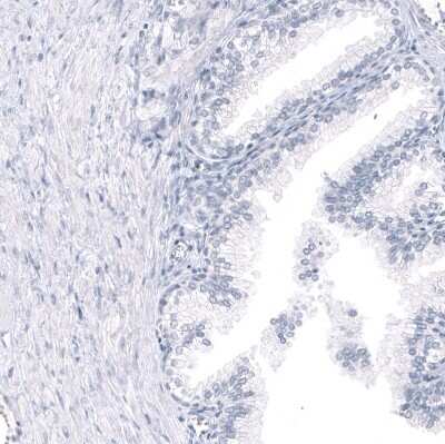 Immunohistochemistry-Paraffin: GPR17 Antibody (CL10474) [NBP3-07993]