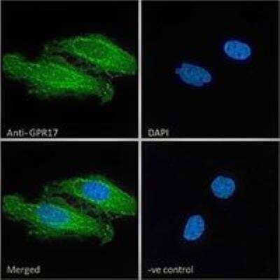 Immunocytochemistry/ Immunofluorescence: GPR17 Antibody [NBP1-51988]