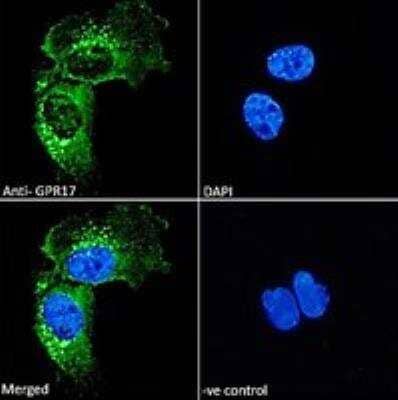 Immunocytochemistry/ Immunofluorescence: GPR17 Antibody [NBP1-51988]