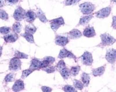 Immunocytochemistry/ Immunofluorescence: GPR17 Antibody - BSA Free [NLS4229]