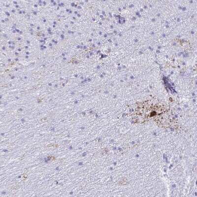 Immunohistochemistry-Paraffin: GPR17 Antibody [NBP1-87531]
