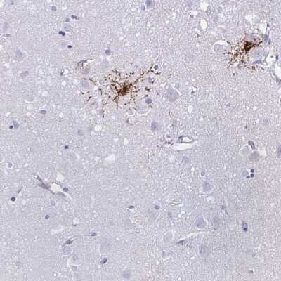 Immunohistochemistry-Paraffin: GPR17 Antibody [NBP1-87531]