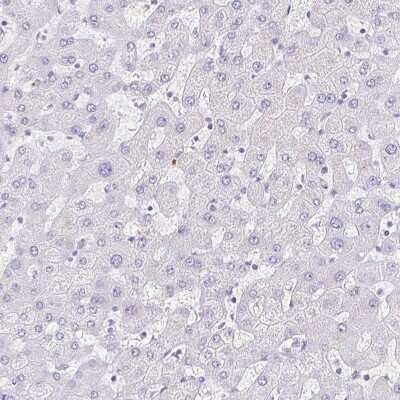 Immunohistochemistry-Paraffin: GPR17 Antibody [NBP1-87531]