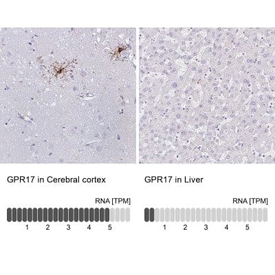 Immunohistochemistry-Paraffin: GPR17 Antibody [NBP1-87531]