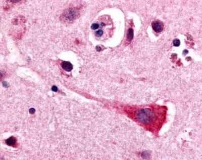 Immunohistochemistry-Paraffin: GPR17 Antibody - BSA Free [NLS4229]