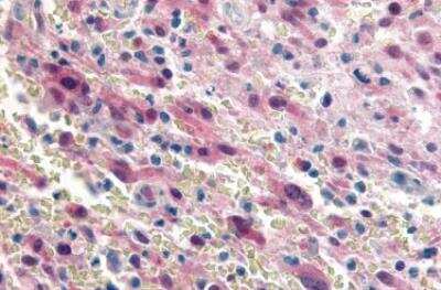 Immunohistochemistry-Paraffin: GPR17 Antibody - BSA Free [NLS4229]