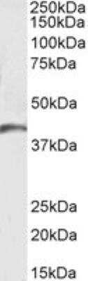 Western Blot: GPR17 Antibody [NBP1-51988]