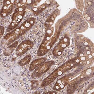 Immunohistochemistry: GPR172A Antibody [NBP2-49382]