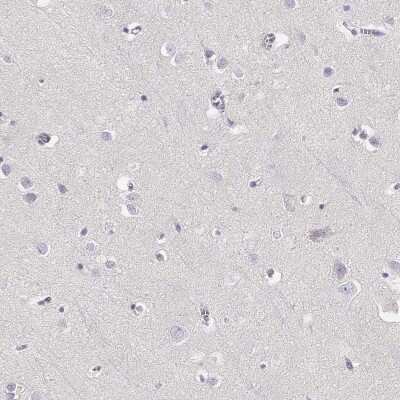 Immunohistochemistry-Paraffin: GPR174 Antibody [NBP1-84667]