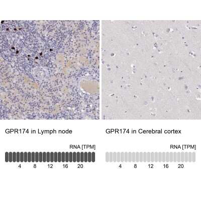 Immunohistochemistry-Paraffin: GPR174 Antibody [NBP1-84667]