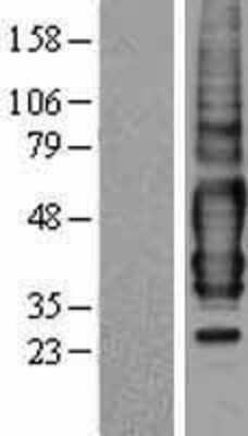 Western Blot: GPR175 Overexpression Lysate [NBP2-11080]