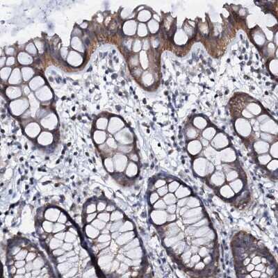 Immunohistochemistry-Paraffin: GPR176 Antibody [NBP2-38457]