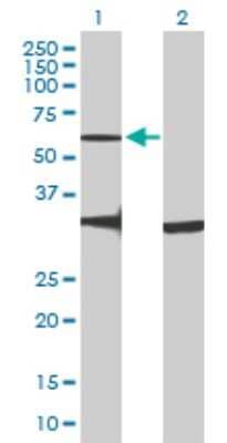 Western Blot: GPR176 Antibody [H00011245-B01P]