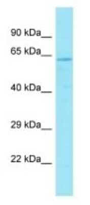 Western Blot: GPR176 Antibody [NBP3-09730]