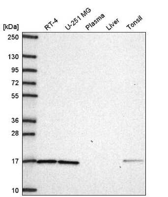 Western Blot: GPR177/WLS Antibody [NBP2-57299]