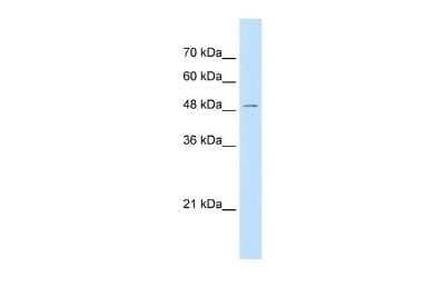 Western Blot: GPR177/WLS Antibody [NBP2-85009]