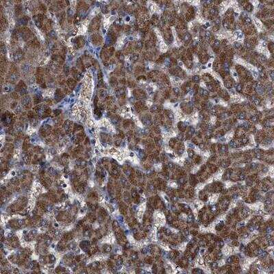 Immunohistochemistry-Paraffin: GPR179 Antibody [NBP1-81797]