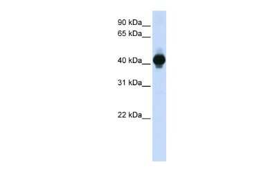 Western Blot: GPR18 Antibody [NBP2-87522]