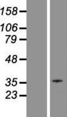 Western Blot: GPR18 Overexpression Lysate [NBP2-10926]