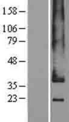 Western Blot: Adrenomedullin R/ADMR/GPR182 Overexpression Lysate [NBL1-11268]