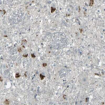 Immunohistochemistry-Paraffin: GPR19 Antibody [NBP1-87572]