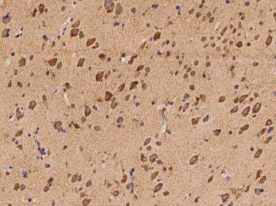 Immunohistochemistry-Paraffin: GPR19 Antibody [NBP3-06027]