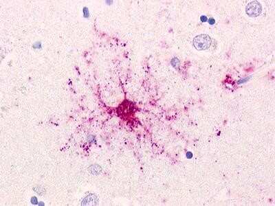 Immunohistochemistry-Paraffin: GPR19 Antibody - BSA Free [NLS98]