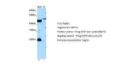 Western Blot: GPR19 Antibody [NBP2-87523]