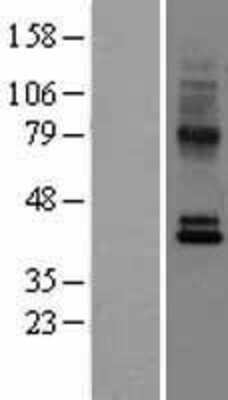 Western Blot: CCR10/GPR2 Overexpression Lysate [NBL1-08888]