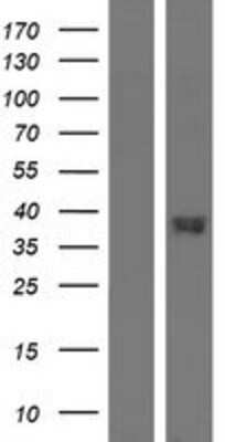 Western Blot: GPR20 Overexpression Lysate [NBP2-04287]