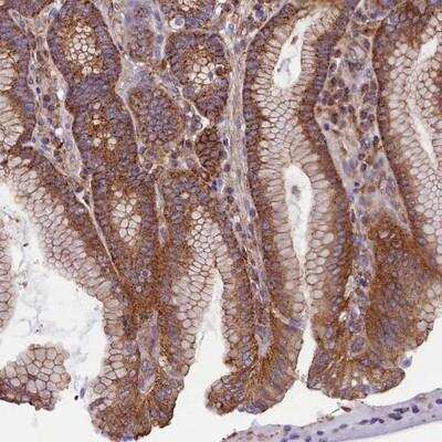 Immunohistochemistry: GPR21 Antibody [NBP1-87504]