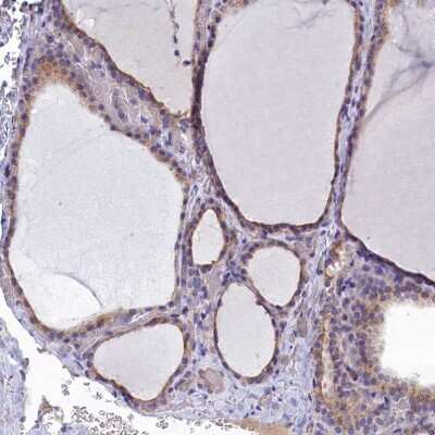 Immunohistochemistry-Paraffin: GPR21 Antibody [NBP1-87504]