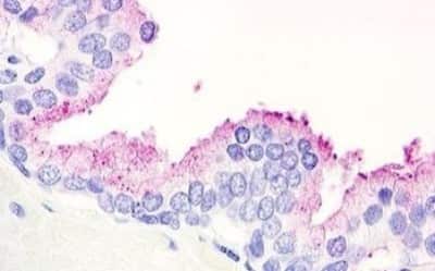 Immunohistochemistry-Paraffin: GPR21 Antibody [NBP3-14353]