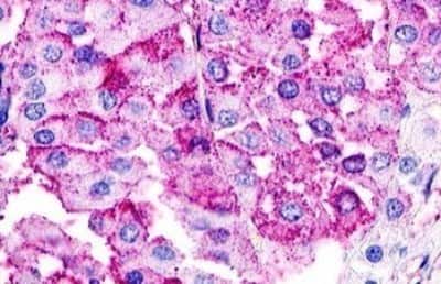 Immunohistochemistry-Paraffin: GPR21 Antibody [NBP3-14353]