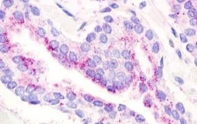 Immunohistochemistry-Paraffin: GPR21 Antibody [NBP3-14354]