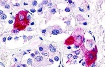 Immunohistochemistry-Paraffin: GPR21 Antibody [NBP3-14354]