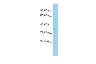 Western Blot: GPR21 Antibody [NBP2-85012]