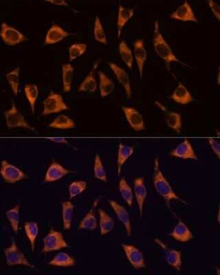 Immunocytochemistry/ Immunofluorescence: GPR22 Antibody - Azide and BSA Free [NBP3-15567]
