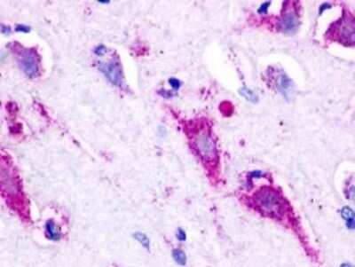 Immunohistochemistry-Paraffin: GPR22 Antibody - BSA Free [NLS109]