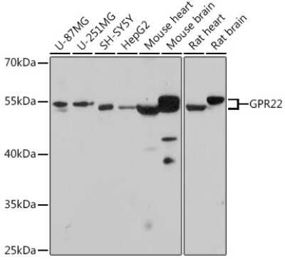 Western Blot: GPR22 AntibodyAzide and BSA Free [NBP3-15567]