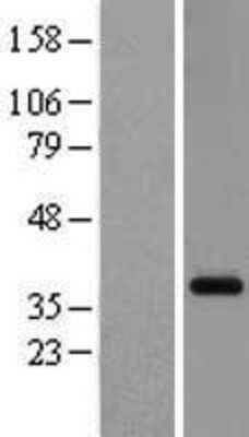 Western Blot: GPR26 Overexpression Lysate [NBL1-11272]