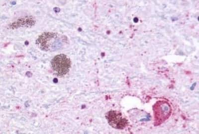 Immunohistochemistry: GPR27 Antibody [NBP3-14356]