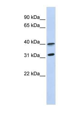 Western Blot: GPR27 Antibody [NBP1-62485]