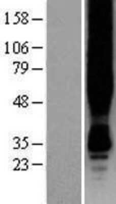 Western Blot: GPER/GPR30 Overexpression Lysate [NBP2-11333]