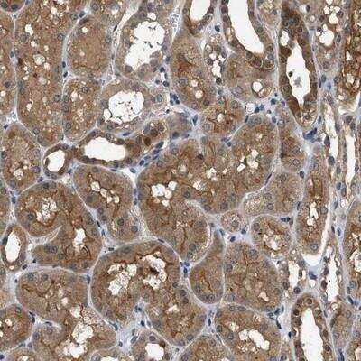 Immunohistochemistry-Paraffin: GPR31 Antibody [NBP1-87468]