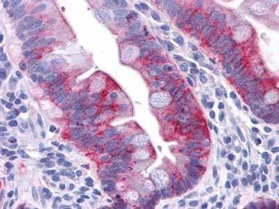 Immunohistochemistry-Paraffin: GPR31 Antibody - BSA Free [NLS1158]