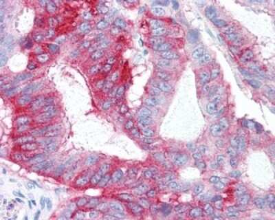 Immunohistochemistry-Paraffin: GPR31 Antibody - BSA Free [NLS1158]