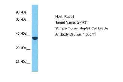 Western Blot: GPR31 Antibody [NBP2-87524]